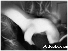 在荧光造影下评估动脉瘤夹闭后情况